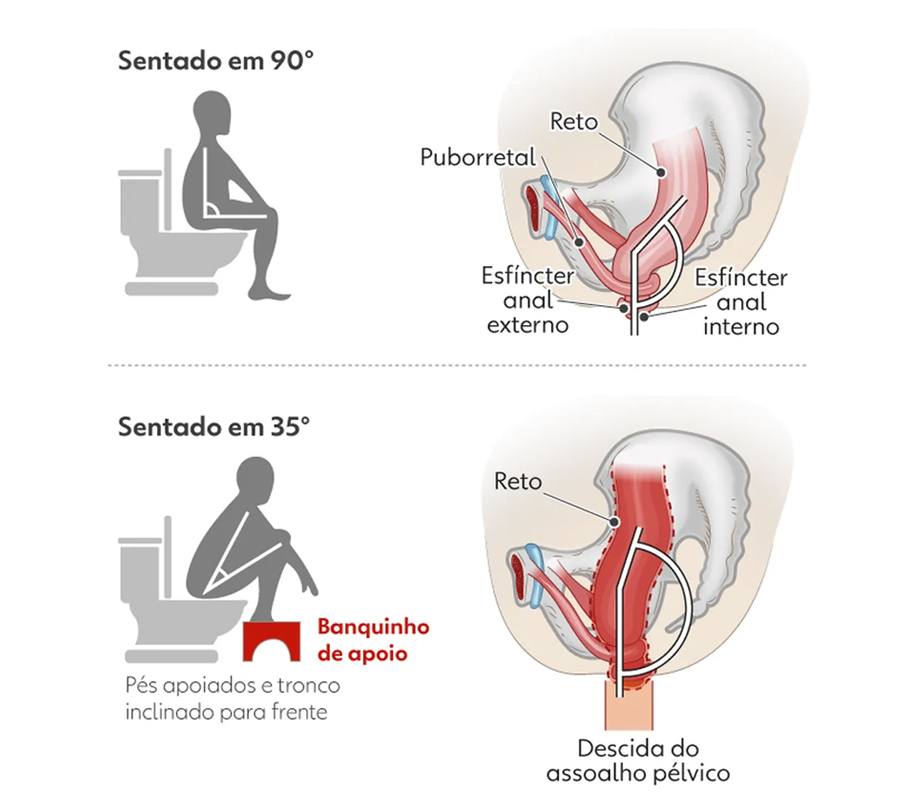 Imagem: Postura adequada para evacuar