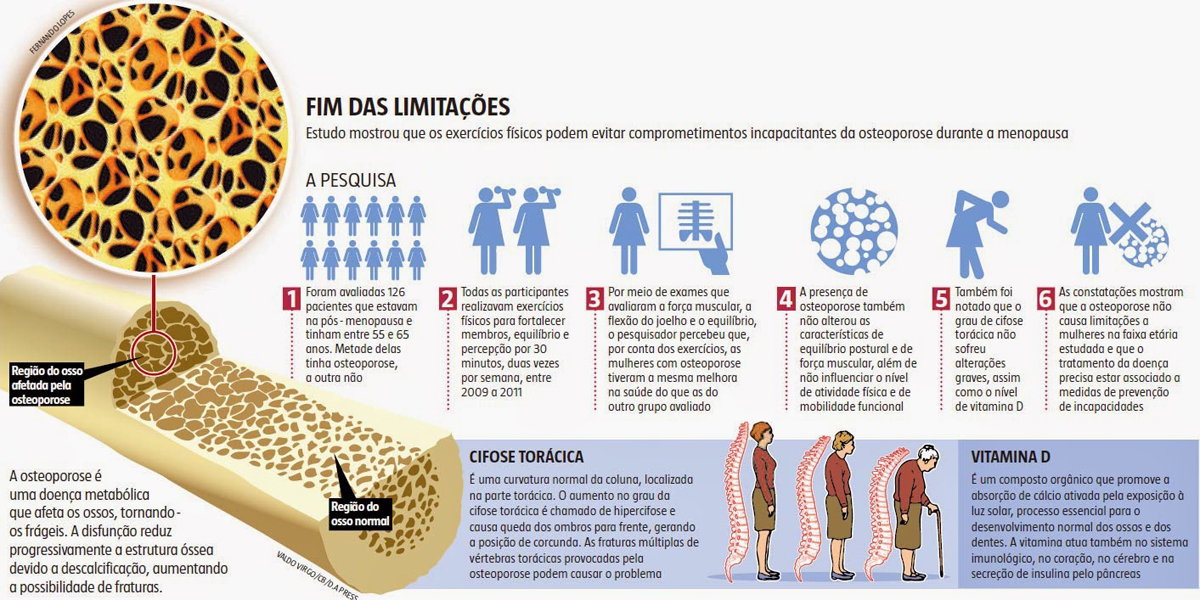 10 milhões de brasileiros sofrem de osteoporose, sendo que, 1 a cada 3 mulheres com mais de 50 anos tem a doença.