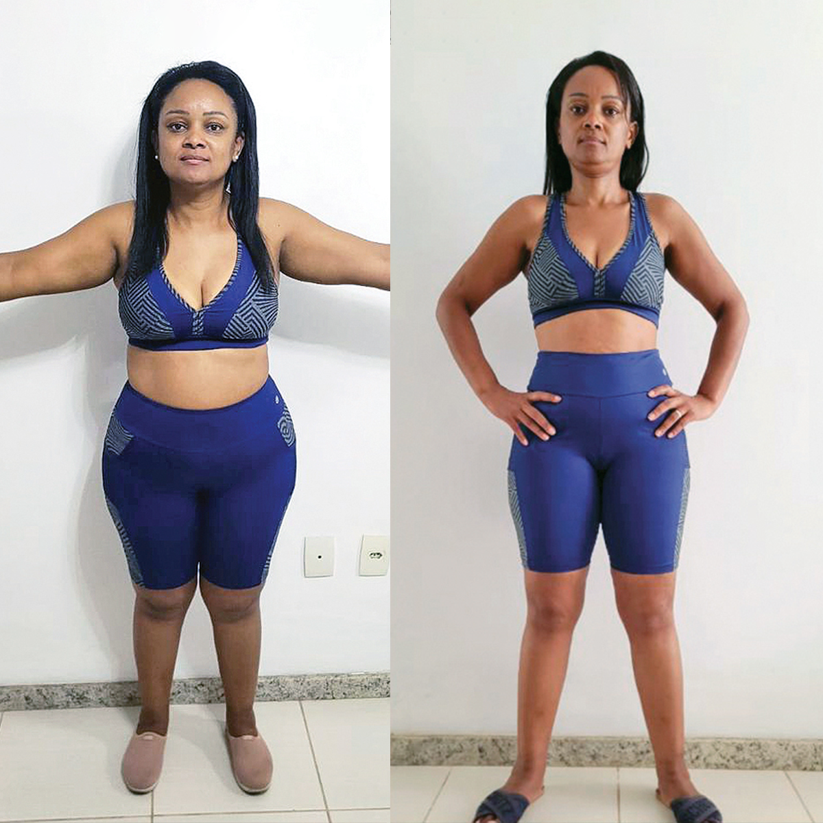 A pedagoga Patrícia Eduvirges Moura conseguiu perder 26 quilos em 6 meses com a ajuda da Dra. Giani